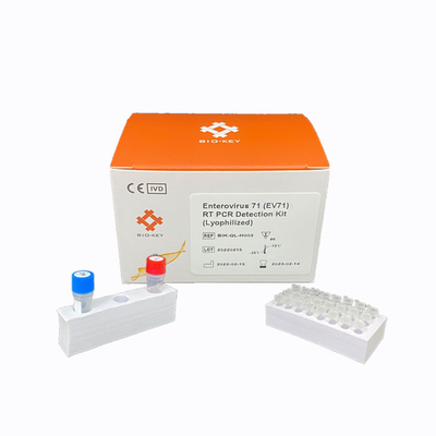 RT PCR Enterovirus 71 Rapid Test Kit ชุดตรวจดีเอ็นเอไลโอฟิไลซ์