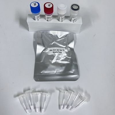 ชุดตรวจพบ PCR ในเวลาจริง